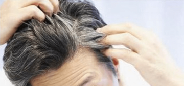 秀丝顿鹿邑植物养发馆教你白发的预防方法