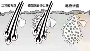 秀丝顿武安植物养发馆告诉你头油是怎么产生的?