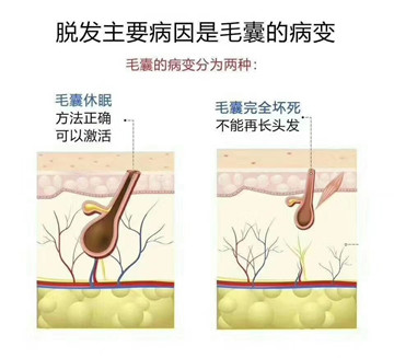 秀丝顿北京植物养发馆温馨提示为什么说植物养发，做的‭‮勤越‬‬越好？