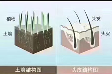 秀丝顿社旗植物养发馆温馨提示生发越早做效果越好
