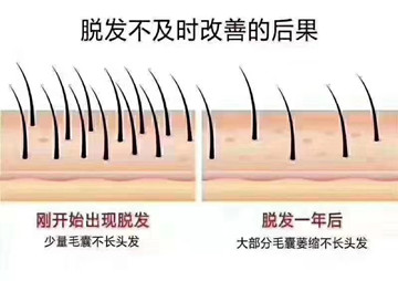 毛囊发展进程