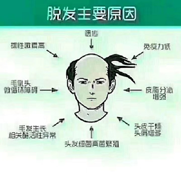 脱发后不生发的原因