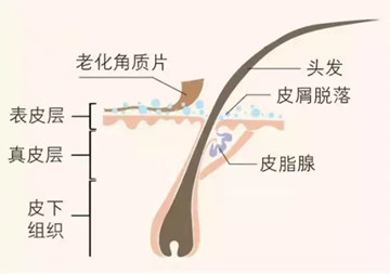 疏通毛囊，去除皮脂堵塞