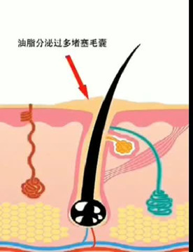 还您健康头皮和毛囊