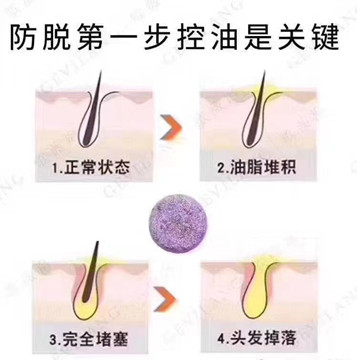防脱生发的三阶段