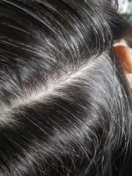 白发不是不可逆的