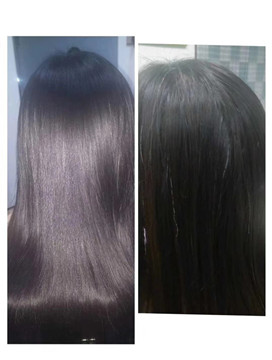 秀丝顿教您告别