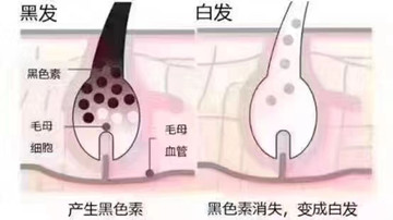 发质的改善和生长是一个漫长的过程