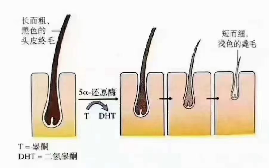 毛囊的发展流程