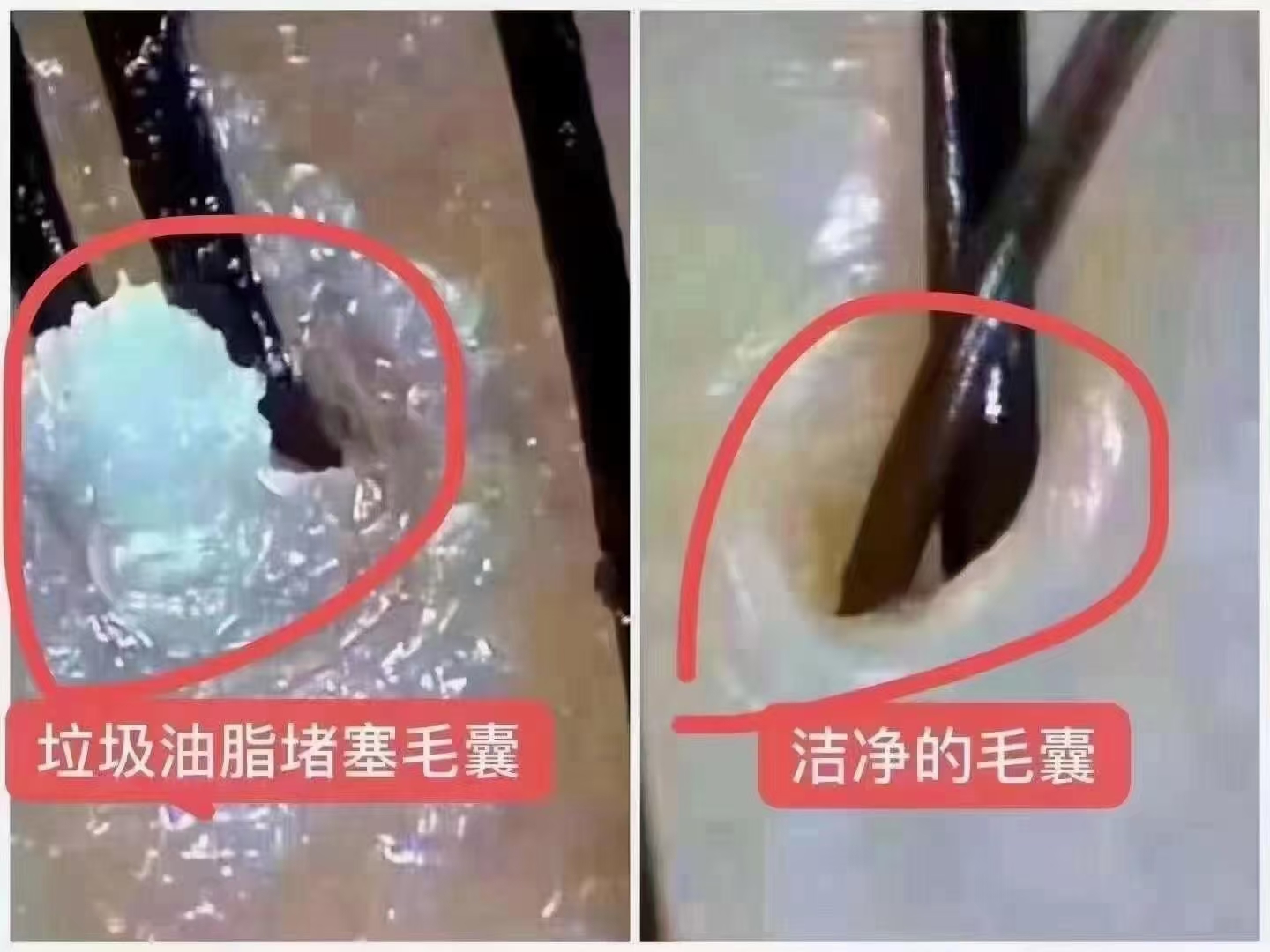 要想头发长的好