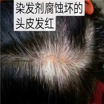 什么样的白发恢复不了？