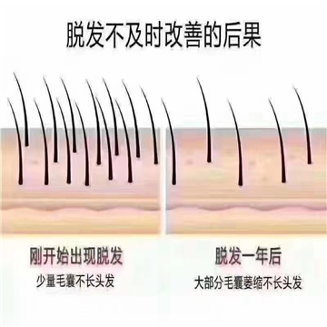 养发馆加盟行业的创举