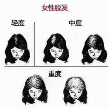 为什么生发育发要尽早？