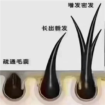 从根本上解决白发问题才是最重要的