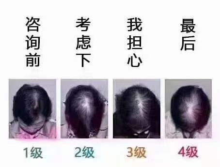 怎样才能让头发好