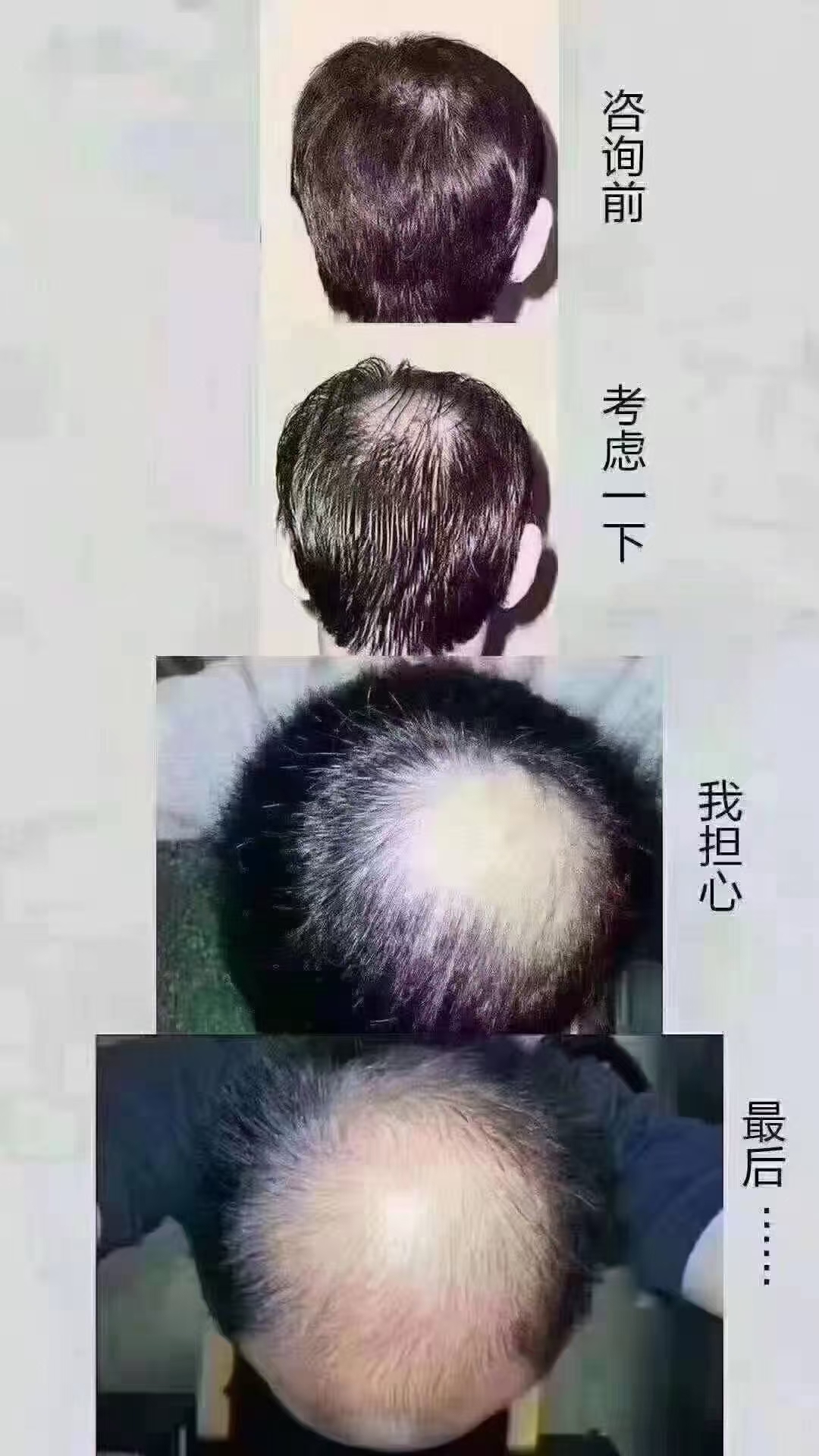 秀丝顿南阳植物养发馆温馨提示脂溢性脱发的特点