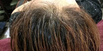 干性中性头发应该注意的洗发小细节