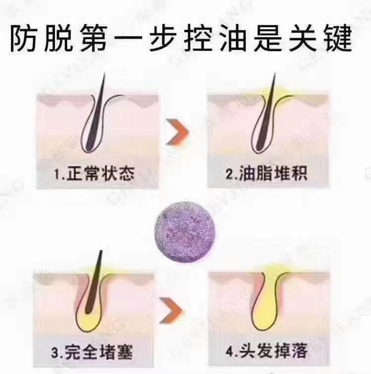 为什么头皮头发不烫不染也要做头皮深层清洁？