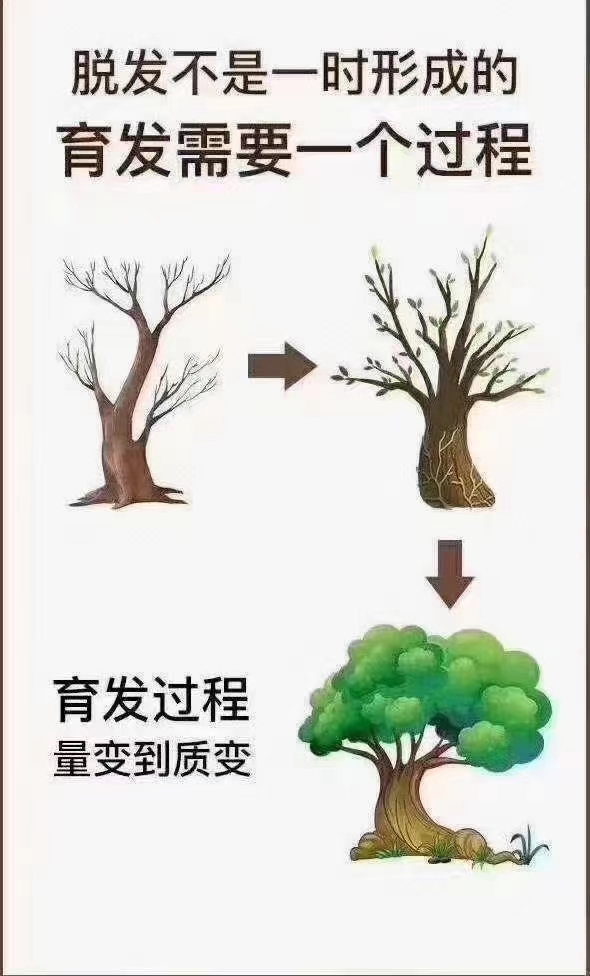 秀丝顿止脱育发