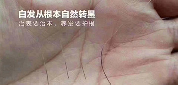 改善白发的方法