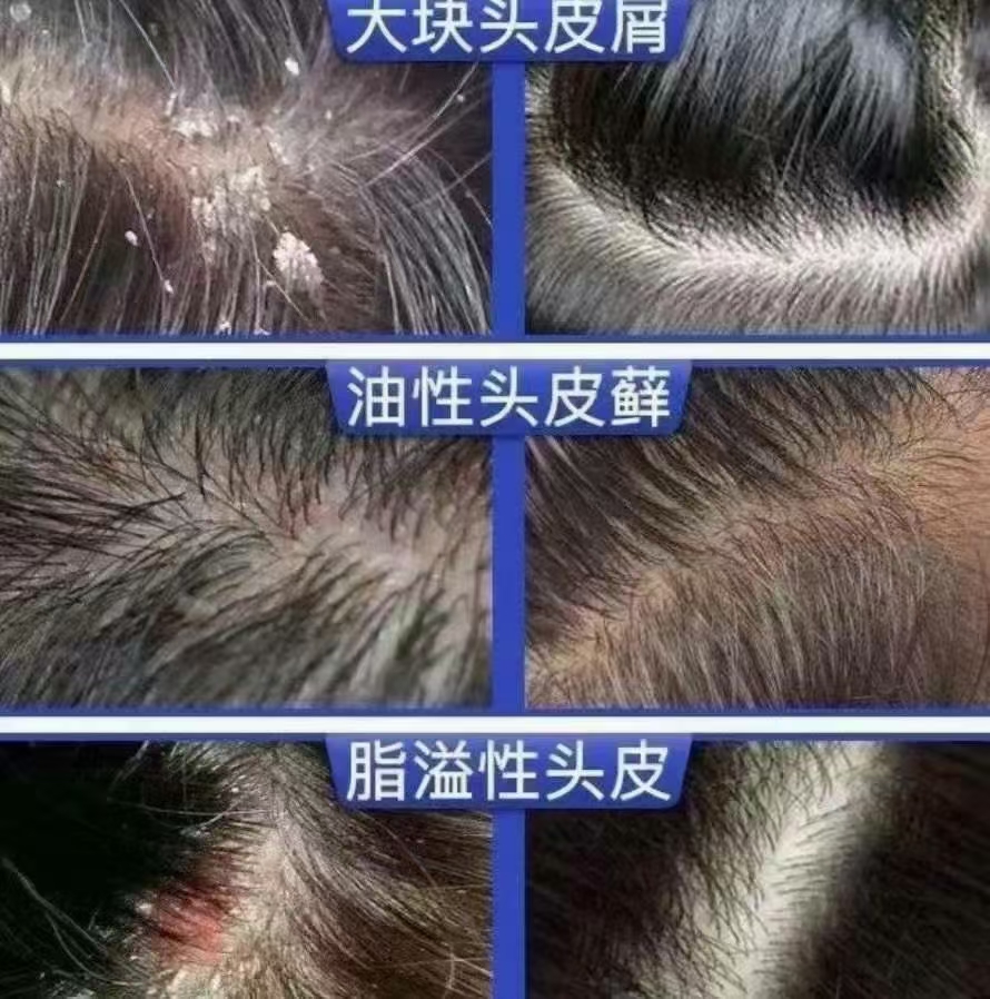 头皮健康，发质自然变好