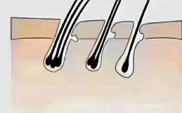 保养从毛囊开始