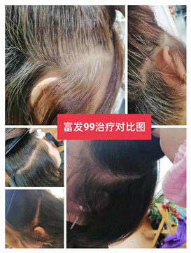 白发用什么染发最安全