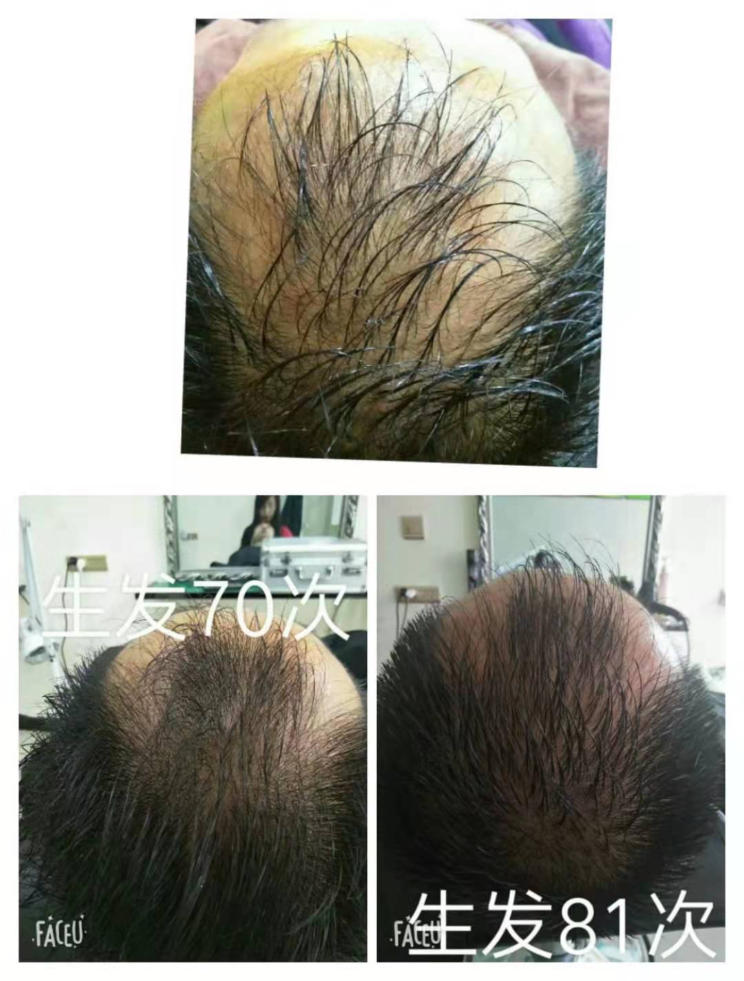 新起点，新疗法