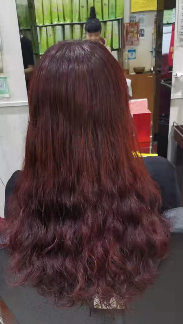 头皮屑产生原因