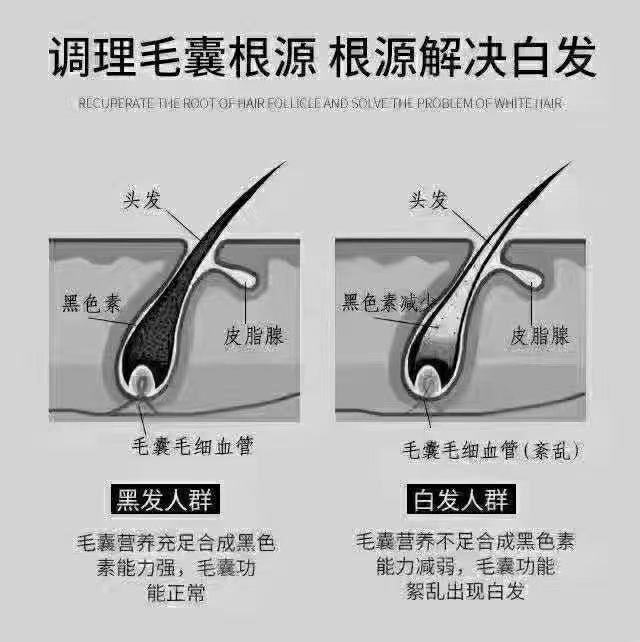 从根本解决白发