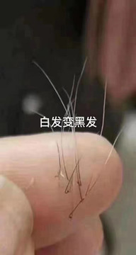 商机无限 就在秀丝顿植物养发馆