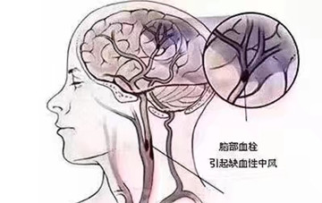 白发的增加速度有多快？