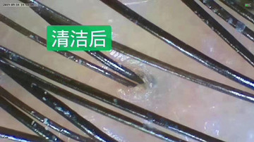 为什么夏天感觉头发掉的多了...