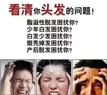 头发毛糙脱落易开叉