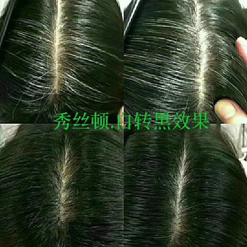 化学染发十大危害