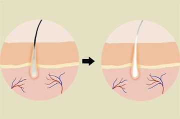 改善白发的方法