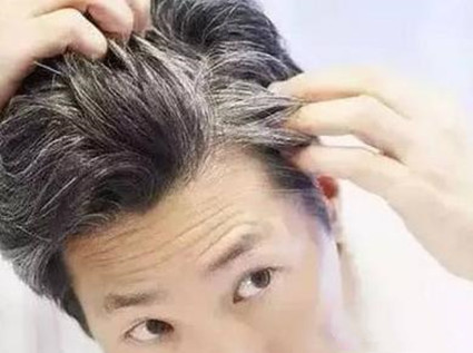 两鬓白发首先出现白发代表什么？