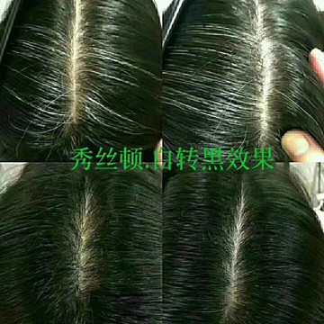 前额白发首先白发代表什么？
