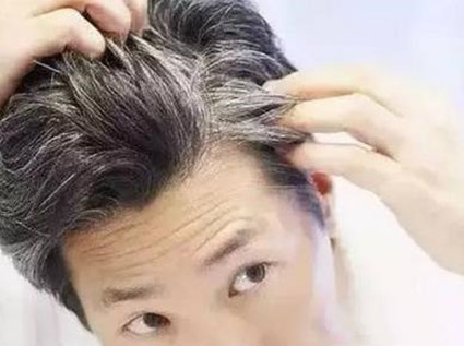 白发位置不同预示不同的健康问题