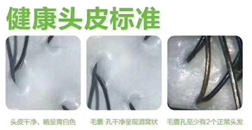 用食疗治疗白发症