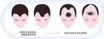 头发不要天天洗