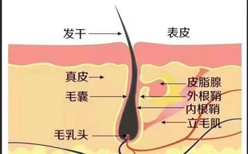 脱发烦恼