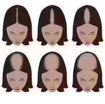 头发干枯毛躁怎么办的呢