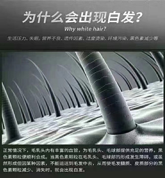 为什么长白发？长白发的原因?