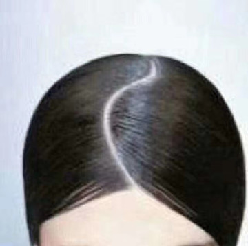 秀丝顿植物养发馆之减少脱发的方法