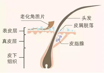 秀丝顿植物养发馆之头发头皮护理的建议