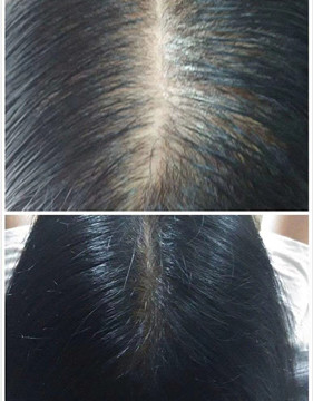 秀丝顿植物养发馆之轻度脱发的症状有哪些？