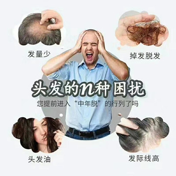 秀丝顿湖南植物养发馆之你是否曾经因为脱发而烦恼？