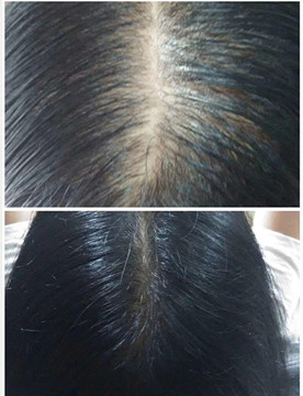秀丝顿植物养发教你秋季养发指南