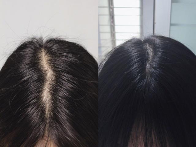 秀丝顿周口植物养发馆之植物养发与传统养发的区别